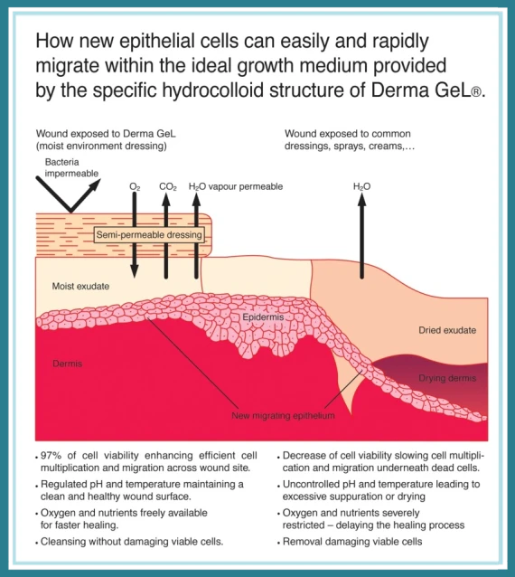 How Derma Gel Works